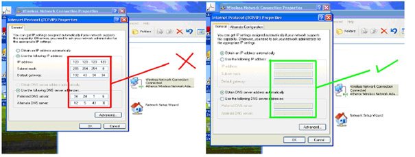 IP address settings